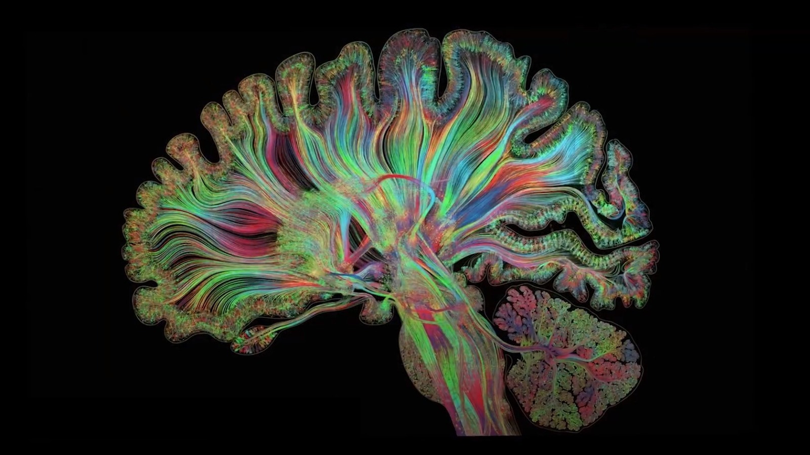 illustration of a brain by gregg dunn
